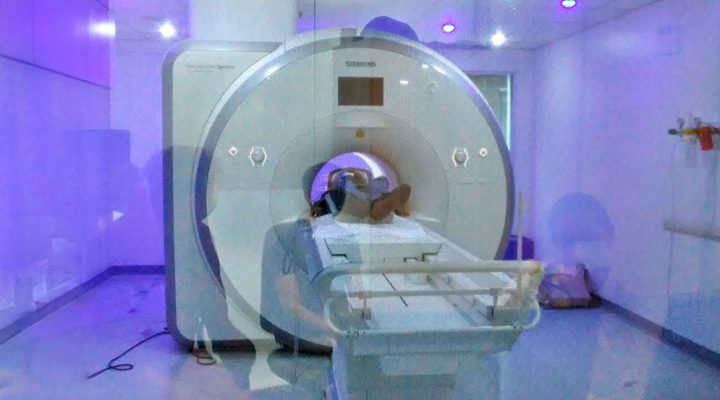 A lo largo de veinte sesiones de fMRI, los científicos pudieron reconstruir cómo el cerebro de la participante se reconfiguraba de forma sistemática y reproducible cada vez que entraba en un NOC